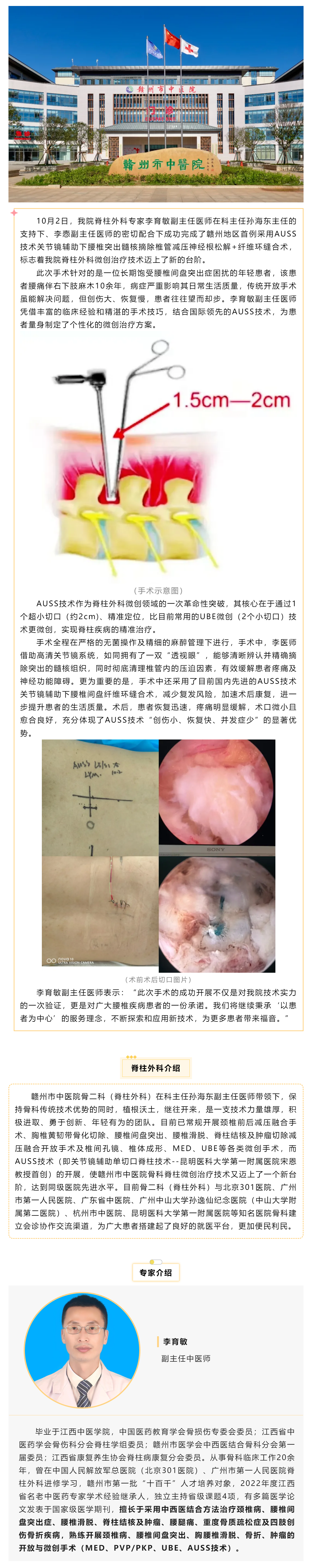 全市首例！我院成功實(shí)施AUSS技術(shù)關(guān)節(jié)鏡輔助下腰椎突出髓核摘除椎管減壓神經(jīng)根松解+纖維環(huán)縫合術(shù).png