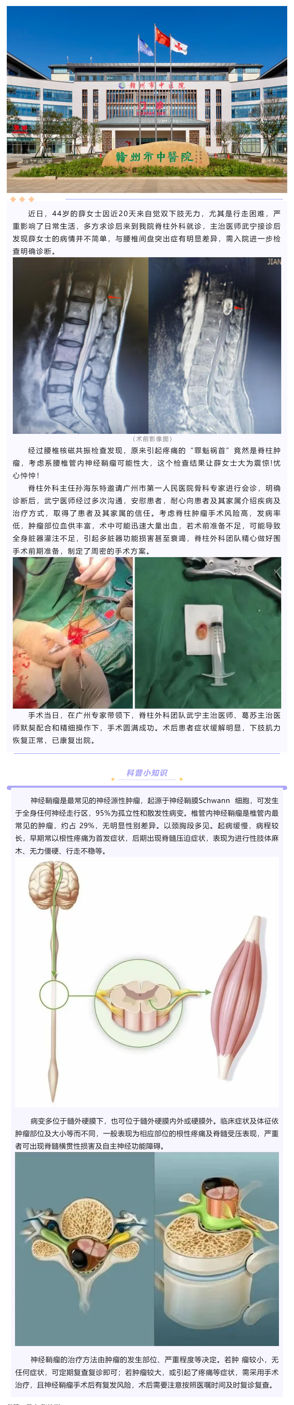 腰腿痛、下肢乏力麻木，提防神經(jīng)鞘瘤！.png