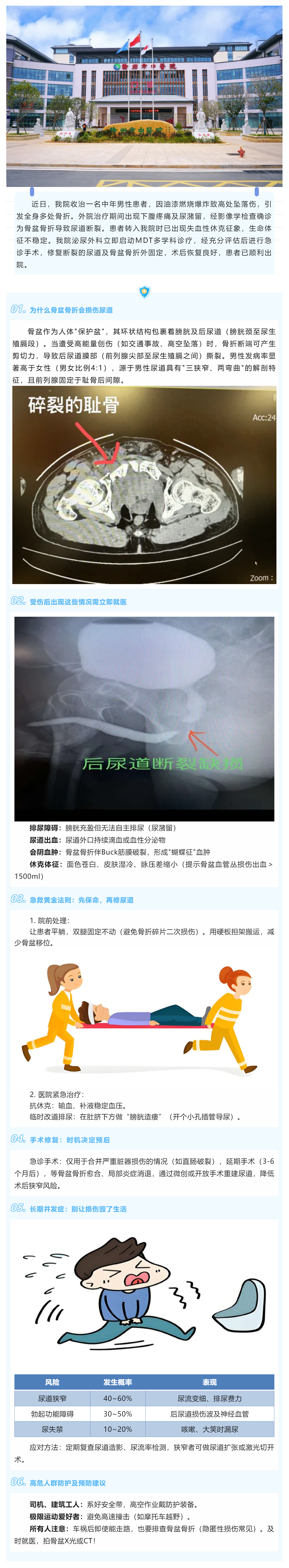 骨盆骨折導致尿道斷裂——不可忽視的“隱形殺手”.png